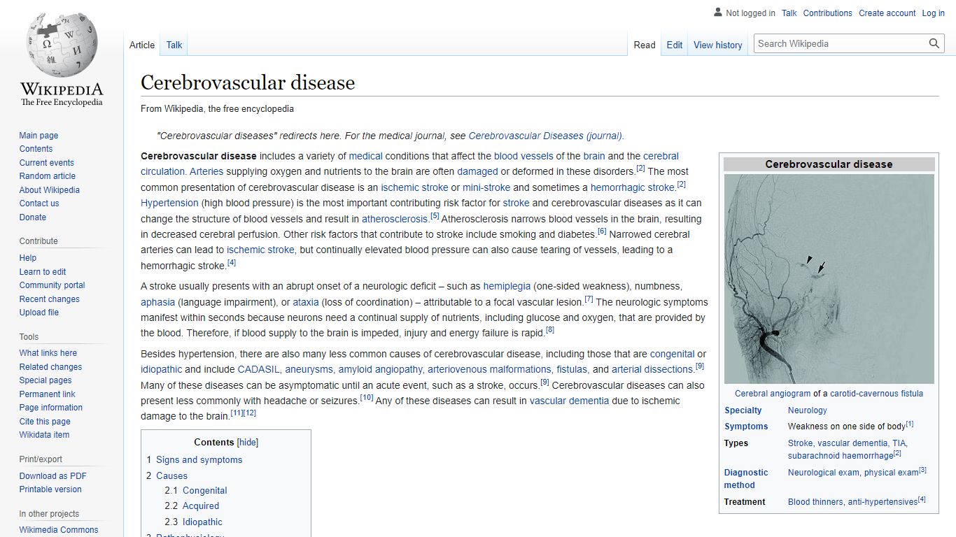 Cerebrovascular disease - Wikipedia